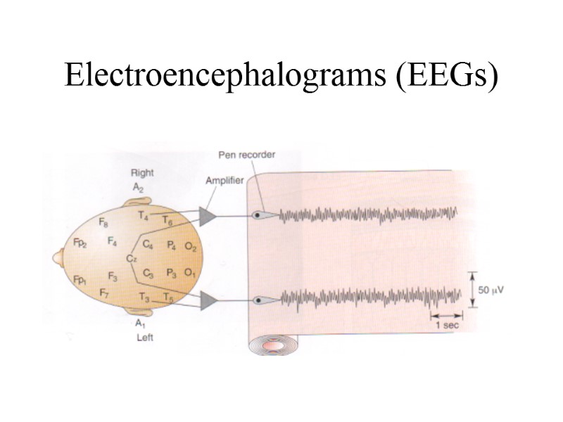 Electroencephalograms (EEGs)